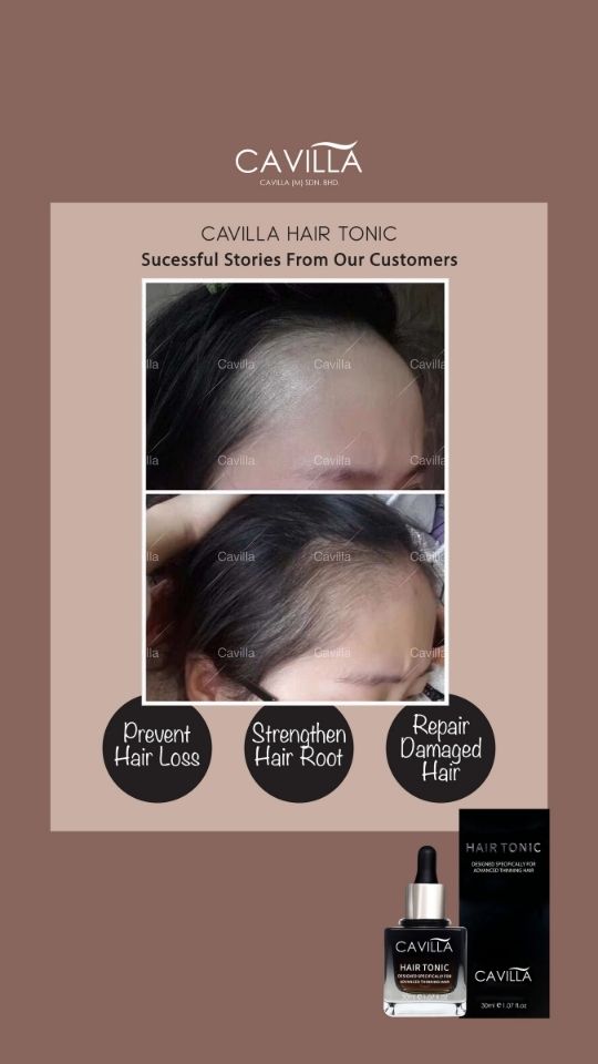 Cavilla Hair Tonic Testimonial